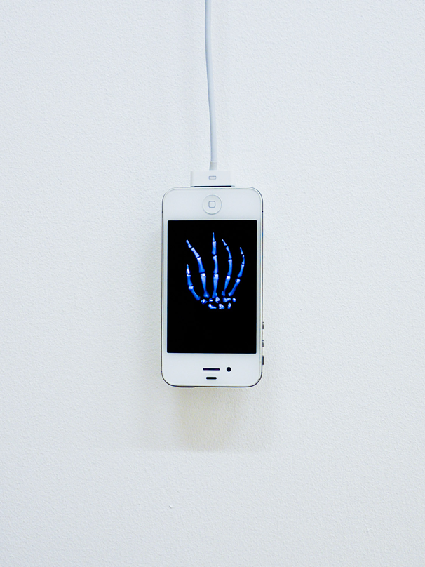 OBJECT / A | Exhibitions | Rowena Harris: The Third Hand Prosthesis